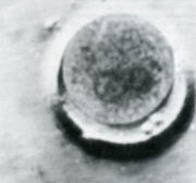 conception photo: 2 parent nuclei combining