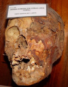 photo of the most ancient mummified human head