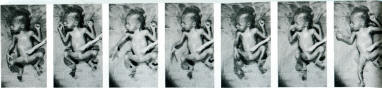 stills from a motion picture of a 6-month foetus