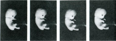 stills from a motion picture of a 7-week foetus