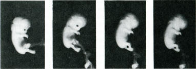 more stills from a motion picture of a 7-week foetus