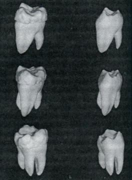 3D volumetric image of a molar